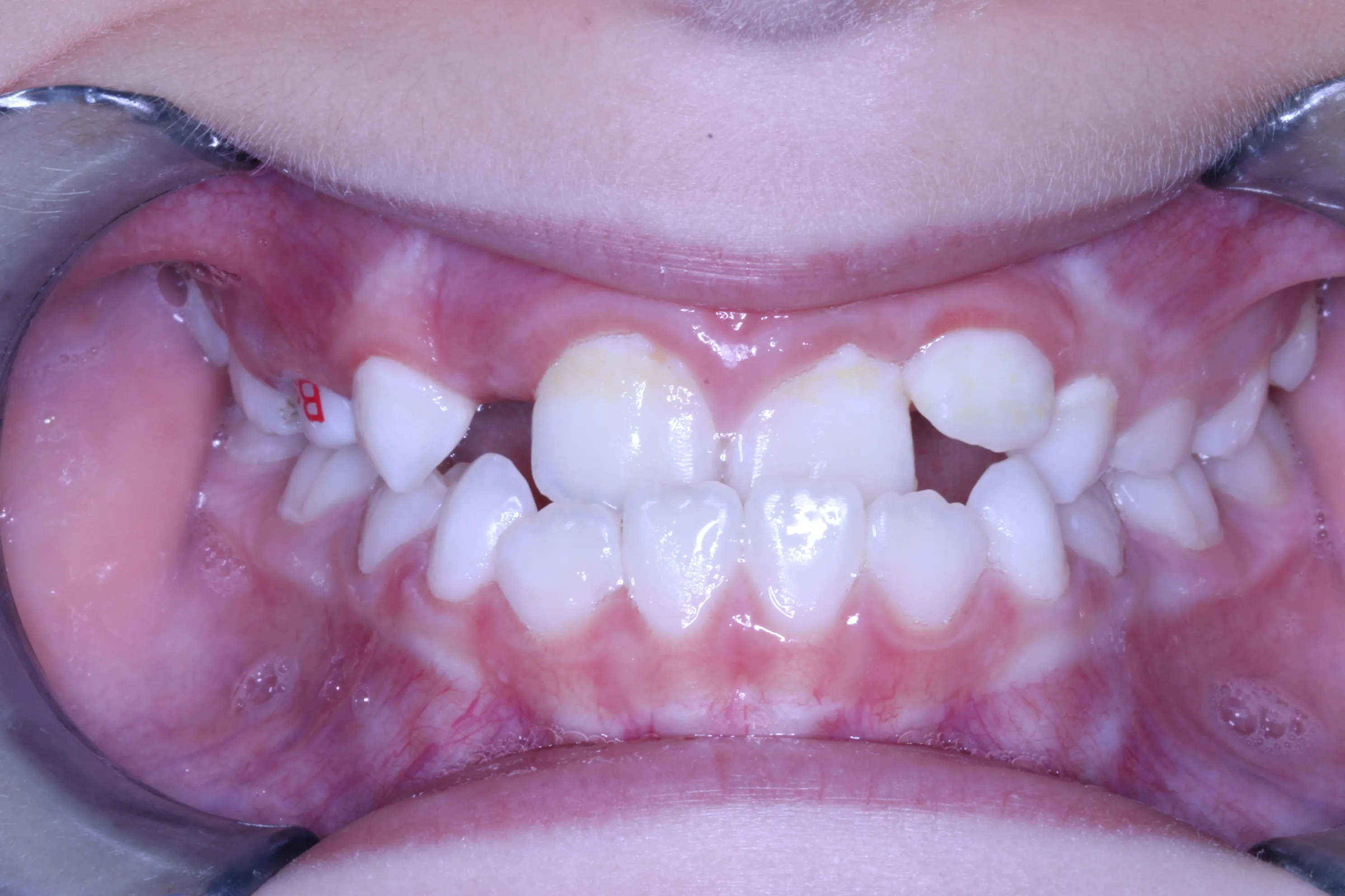 smile-gallery gallery